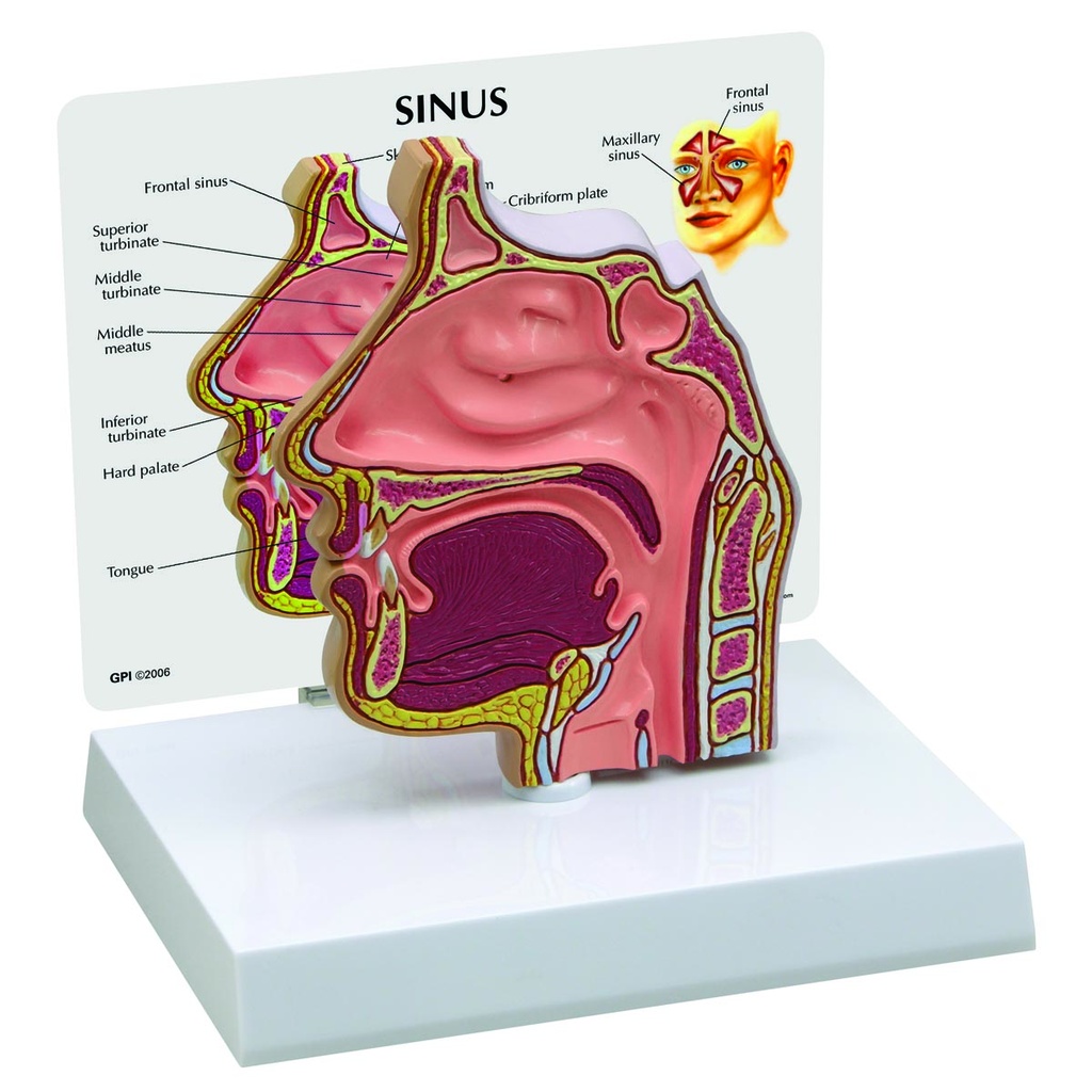 Sección transversal del seno nasal.   