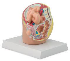 Hernia inguinal indirecta. Modelo de 1/2 de su tamaño natural, muestra la sección medial y sagital de la pelvis humana masculina con una hernia inguinal indirecta.