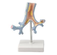 Modelo patológico de los bronquios.