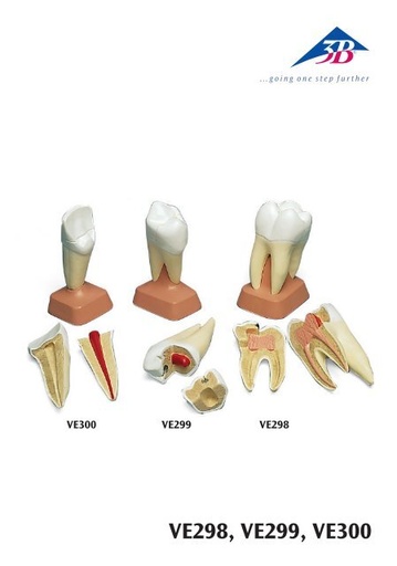 [VE298] Molar superior tres raices 2 piezas