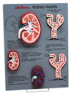 [WA19631] Kit de enseñanza enfermedad renal